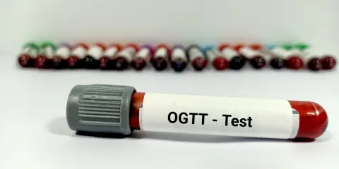 Probówka z oznaczeniem "OGTT - Test" na tle wielu innych próbek krwi. To ważny etap w diagnostyce cukrzycy, czyli test obciążenia glukozą.