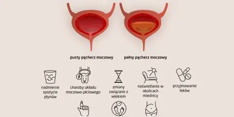 Ilustracja przedstawia przyczyny częstego oddawania moczu w dużych ilościach: nadmierne picie, choroby układu moczowo-płciowego, wiek, naświetlanie, leki, cukrzyca, nadwaga, ciąża.