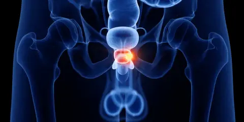 Anatomical rendering of the male pelvic region, highlighting the prostate with a glowing red area indicating a potential issue. Pytanie: czy prostatę można wyleczyć?