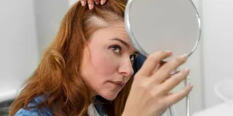 Caída del cabello: ¿Qué funciona sin receta? Guía experta