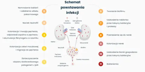 Schemat powstawania infekcji dróg moczowych, od zanieczyszczenia jelitowego po zapalenie dolnych dróg moczowych i bakteriemię.