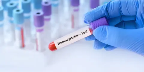 Podwyższona homocysteina: Co oznacza i jak ją skutecznie obniżyć?