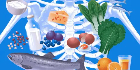 Alimentos clave para una dieta para osteoporosis: lácteos, pescado, huevos, verduras de hoja verde, frutas y legumbres, rodeando un esqueleto.