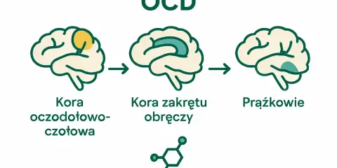 Ilustracja pokazuje, co to jest OCD: zmiany w korze mózgowej, w tym kora oczodołowo-czołowa i kora zakrętu obręczy, oraz prążkowia.