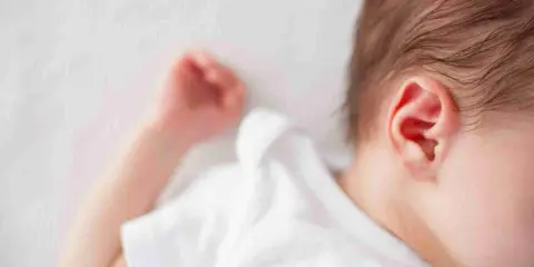 Un neonato dorme troppo, con la testolina appoggiata su un morbido lettino bianco. Si intravede un orecchio rosa e una manina.