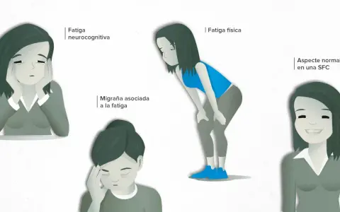 Síntomas de fatiga crónica: ¿Es más que cansancio normal?