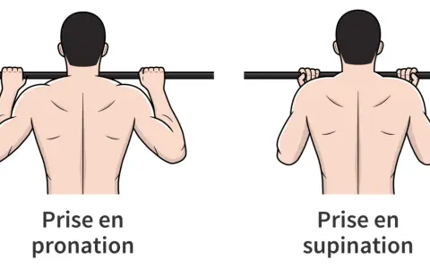 Comparaison de la prise en pronation et supination pour un exercice de traction. La pronation traction sollicite différemment les muscles du dos.
