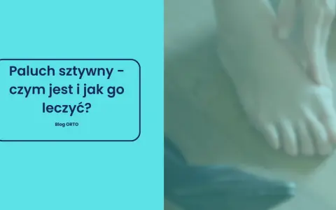Paluch sztywny – co to za schorzenie i jak sobie z nim radzić? Na zdjęciu widać stopę, która może cierpieć z powodu tej dolegliwości.