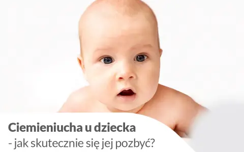 Urocze niemowlę z zaciekawioną miną. Tekst informuje o ciemieniuchy u dziecka i sposobach jej usuwania.