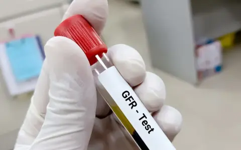 Rękawiczka trzyma probówkę z oznaczeniem "GFR - Test". To jedno z badań na nerki, które ocenia ich pracę.