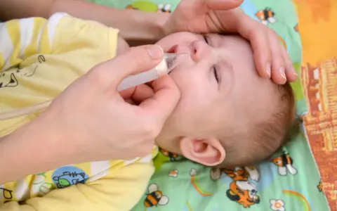 Mani che usano un aspiratore nasale per un neonato con raffreddore. Il piccolo indossa una tutina gialla con disegni di animali.