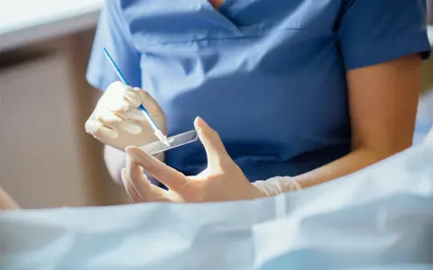 Lekarz w rękawiczkach przygotowuje preparat do badania cytologicznego, które pozwala wykryć zmiany w komórkach.
