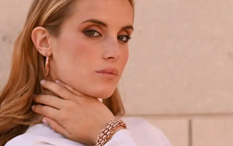 Donna con lentiggini e gioielli in oro rosa, un bracciale a maglie larghe e orecchini a cerchio.