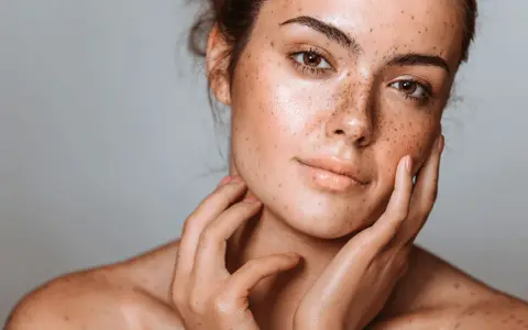 Visage d'une jeune femme aux taches brunes naturelles, ses mains caressant délicatement sa peau.