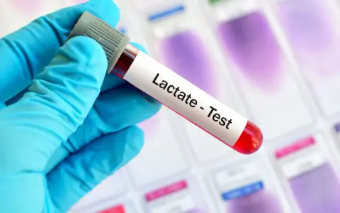 Ręka w niebieskiej rękawiczce trzyma probówkę z krwią do testu na mleczany. Wynik może pomóc zdiagnozować kwasicę mleczanową.