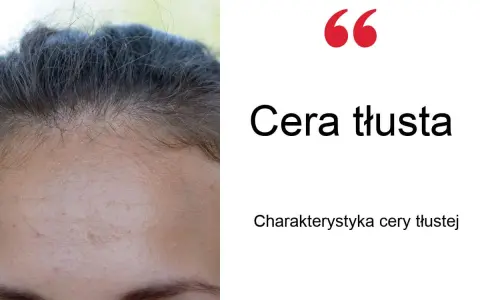 Tłusta cera? Poznaj sprawdzone sposoby na matową skórę bez błyszczenia.