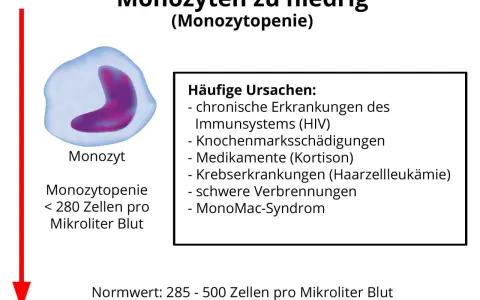 Bild zeigt einen Monozyten und erklärt, dass zu niedrige Monozyten (Monozytopenie) durch HIV, Medikamente oder schwere Verbrennungen verursacht werden können.