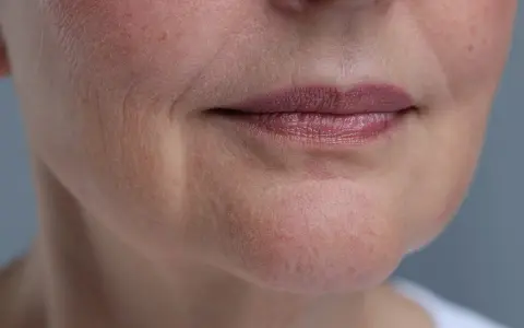 Zbliżenie na usta i podbródek, widoczne zmarszczki przy ustach, oznaki upływu czasu na skórze.