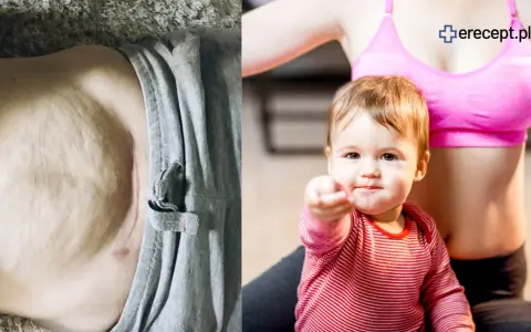 Brzuch po ciąży i dziecko. Jak schudnąć po ciąży? Ćwiczenia i dieta to klucz do sukcesu.