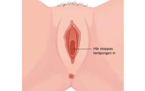 Illustration av kvinnliga könsorgan med texten "Här stoppas tampongen in". Det kan kännas som att det bubblar i underlivet vid mens.