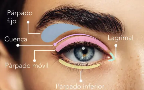 Diagrama de ojo con áreas coloreadas: párpado fijo, cuenca, párpado móvil, lagrimal y párpado inferior.