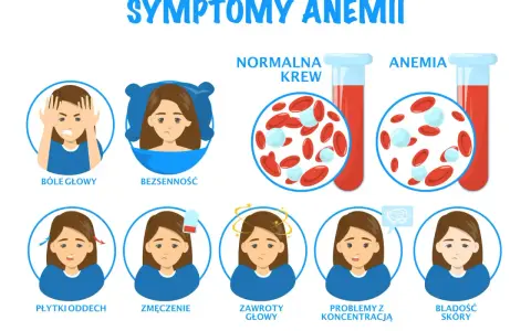 Objawy anemii u niemowlaka: bóle głowy, bezsenność, płytki oddech, zmęczenie, zawroty głowy, problemy z koncentracją, bladość skóry.