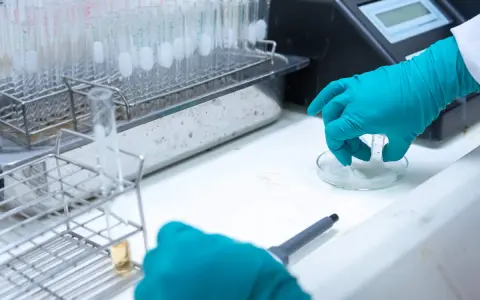 Badanie próbek kału w laboratorium, wykrywanie krwi utajonej w kale, kod ICD-10.