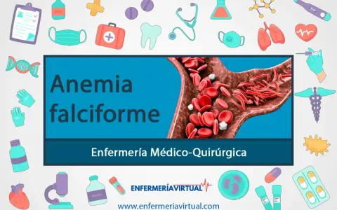 Anemia falciforme: glóbulos rojos con forma de hoz bloquean el flujo sanguíneo. Ilustración médica con iconos de salud.