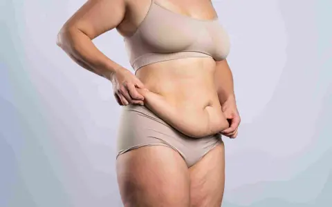 Kobieta w bieliźnie pokazuje fałdy brzuszne, rozważając abdominoplastykę.