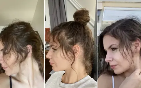 Trois profils d'une femme montrant la repousse de ses cheveux, notamment le **cheveux cassé devant** qui s'estompe.