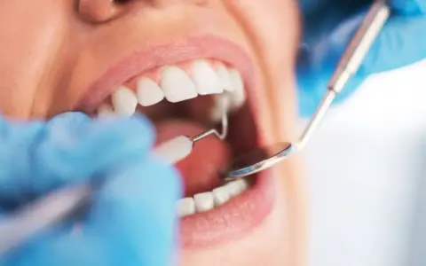 Dentysta wykonuje sanację jamy ustnej, używając lusterka i szczoteczki do czyszczenia zębów.