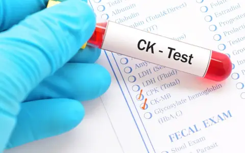 Ręka w niebieskiej rękawiczce trzyma probówkę z krwią do testu CK, czyli kinazy kreatynowej. Zaznaczono opcje CPK (Total) i CK-MB.