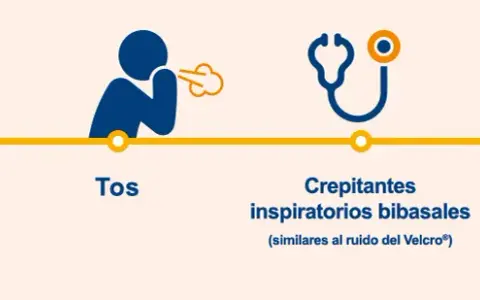 Fibrosis pulmonar: ¿Reconoces sus síntomas? Guía esencial