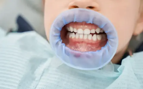 Uśmiechnięte siekacze u dziecka, gotowe na wizytę u dentysty.