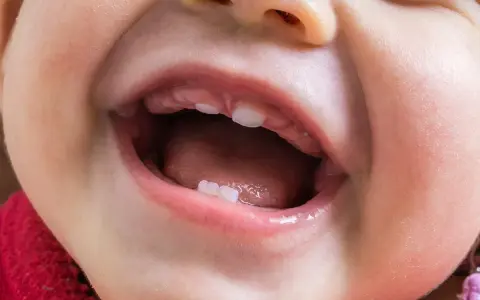 Uśmiechnięte dziecko z widocznymi ząbkami, które mogą wskazywać na nieprawidłową kolejność wyrzynania się zębów.