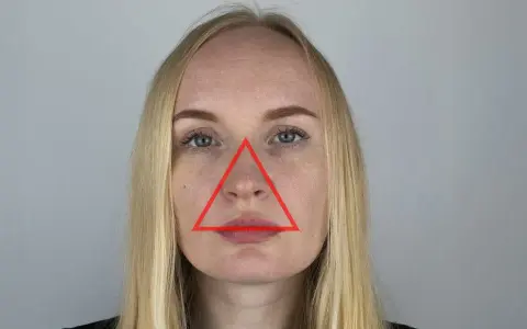 Gdzie nie wyciskać pryszczy? Unikaj tych niebezpiecznych miejsc