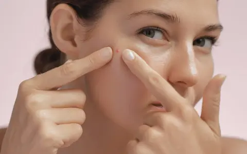 Une femme examine un furoncle sur son visage, ses doigts pointant vers la petite imperfection rouge sur sa joue.