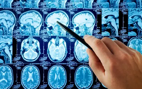 Jakie choroby psychiczne wykryje rezonans magnetyczny głowy i jak to działa