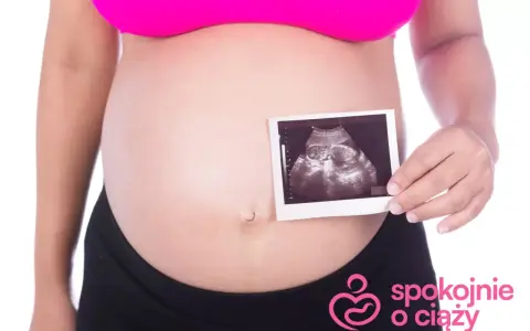 Brzuszek w ciąży, na którym widać zdjęcie USG. To zdjęcie pokazuje, w którym tygodniu widac plec maluszka.