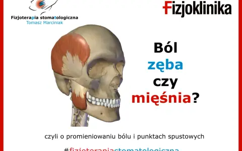 Model czaszki z zaznaczonym mięśniem żwaczem, obok tekst: "Ból zęba czy mięśnia?".