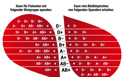 Blutgruppe 0 positiv ist ein universeller Spender. Die Tabelle zeigt, wer von wem Blut erhalten kann.