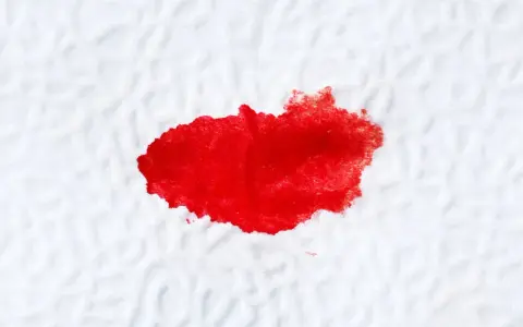 Plama krwi na białym materiale, przypominająca ślady po problemach z odbytem.