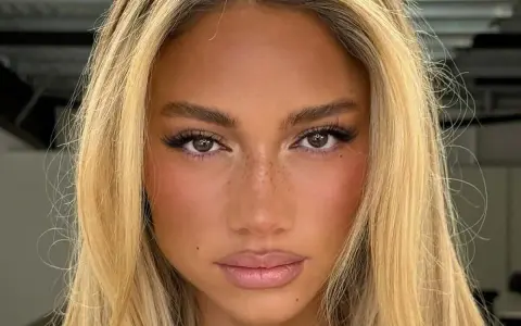 Primer plano de una mujer con cabello rubio y ojos separados, pecas sutiles y labios rosados.