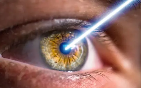 Un occhio solo, con un raggio laser che lo colpisce.