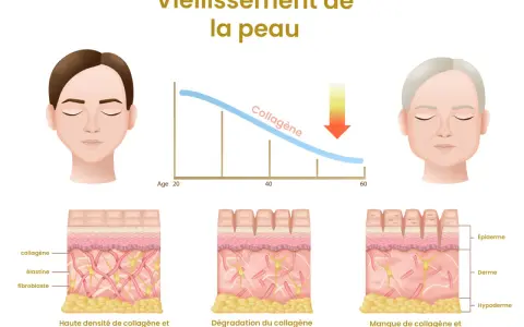 Le vieillissement cutané, marqué par une baisse du collagène, peut entraîner des dangers pour la peau. L'image montre la diminution du collagène avec l'âge.