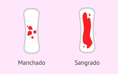 Dos compresas: una con manchado leve y otra con sangrado abundante. Puede ser un signo de embarazo con la regla.