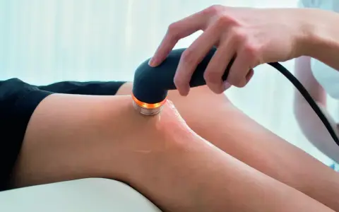 Fizjoterapeuta stosuje terapię ultradźwiękami na kolano pacjenta, by przyspieszyć regenerację.