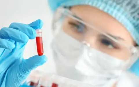 W laboratorium mikrobiologicznym analizuje się próbki, jak ta z krwią, by wykryć i badać mikroorganizmy.