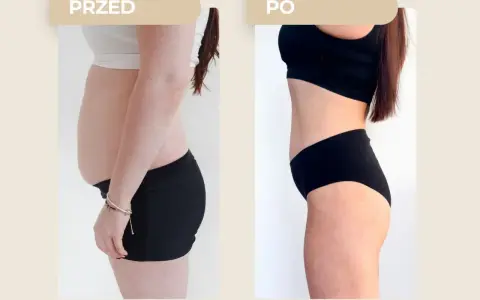 Przed i po metamorfozie: widoczna zmiana sylwetki, która pokazuje, jak schudnąć 5 kg.