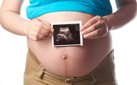 Schwanger in der 21. SSW: Ein Ultraschallbild zeigt das Baby.